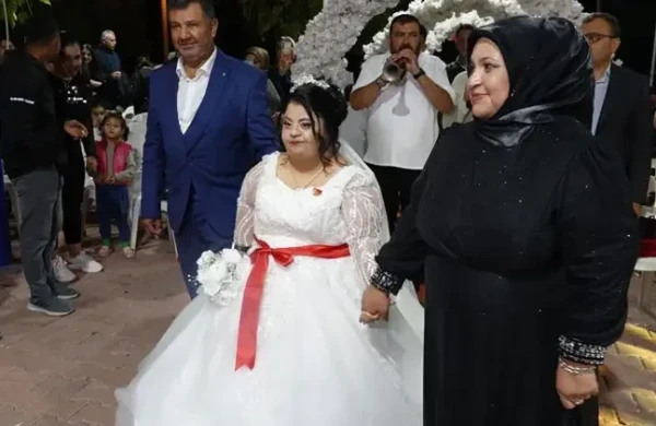 Daun sindromlu qız ad günündə arzusuna çatdı&nbsp;&nbsp;