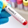 "Hepatit C" xəstəliyi ilə&nbsp; bağlı həkim XƏBƏRDARLIQ EDİR