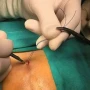 Tük dönməsinin əsas səbəbləri nələrdir?&nbsp; HƏKİM DANIŞDI