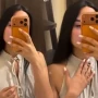 Bloger botoksdan sonra qolunun iflic olduğunu deyir
