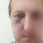 Xalq artistinin oğlunu döyməyə görə daha 2 şəxs saxlanıldı&nbsp;