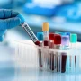Alzheimer xəstəliyinin erkən diaqnozunda inqilab