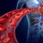 Stent qoyduranlar və təzyiq xəstələri bu xətanı edir! —&nbsp; AÇIQLAMA
